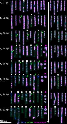 Viral infection impacts the 3D subcellular structure of the abundant marine diatom Guinardia delicatula